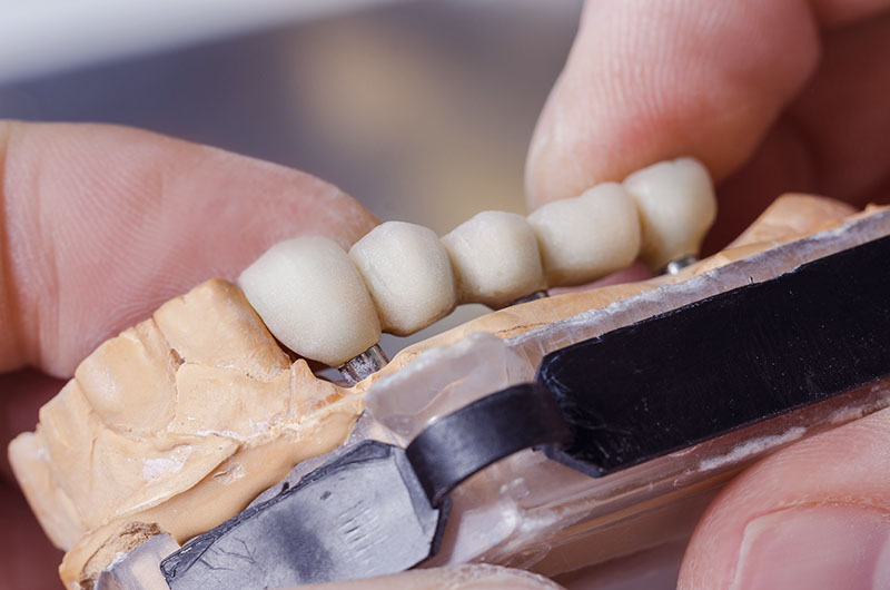 dental technician preparing dental bridge