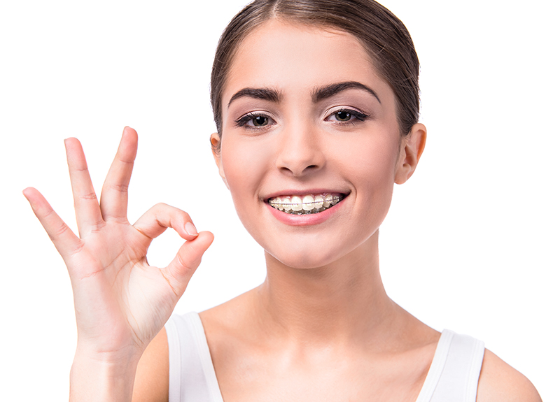 Clear Aligners vs Clear Braces